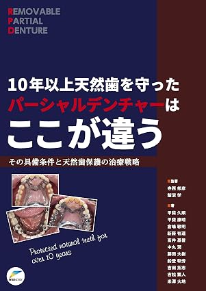10年以上天然歯を守ったパーシャルデンチャーはここが違う