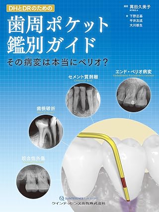 DHとDRのための歯周ポケット鑑別ガイド