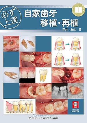 必ず上達 自家歯牙移植・再植